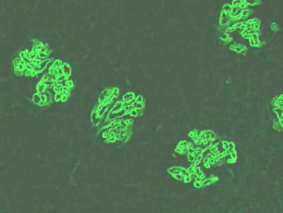 绵羊抗大鼠肾小球基底膜血清 Sheep Anti-Rat A