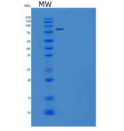 小鼠EphB4 / HTK重组蛋白Fc tag