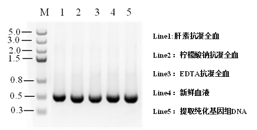 免提取PCR试剂盒：Blood Direct PCR Kit
