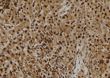 TIE2 (phospho Tyr897) antibody