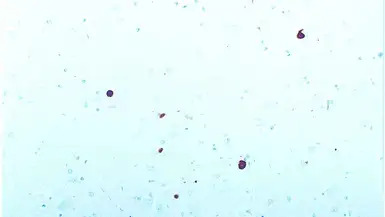 alpha Synuclein antibody [KM51