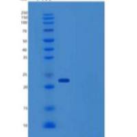 人HRAS / GTPase重组蛋白His tag