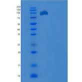人ELK1 重组蛋白His & GST tag