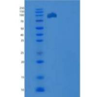 人ELK1 重组蛋白His & GST tag