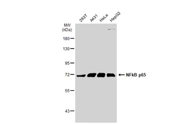NFkB p65 antibody [GT1185]