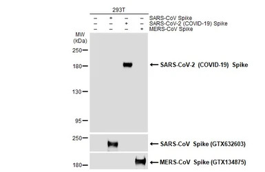 SARS-CoV-2 (COVID-19) Spike an