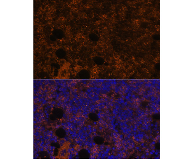 CD11B Rabbit Polyclonal Antibo