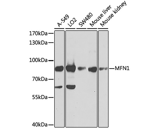 MFN1/Mitofusin-1 Rabbit Polycl