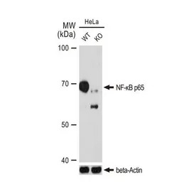 NFkB p65 antibody [GT1185]