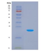 人泛素交叉反应蛋白(UCRP)重组蛋白