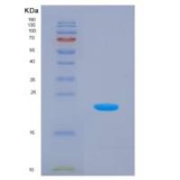 人泛素交叉反应蛋白(UCRP)重组蛋白