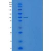 人白介素13(IL13)重组蛋白Fc Tag
