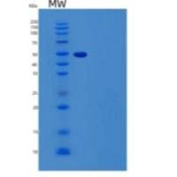 人粒钙蛋白(GCA)重组蛋白N-GST