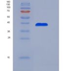 人趋化因子配体14(CXCL14)重组蛋白