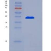 人趋化因子配体14(CXCL14)重组蛋白