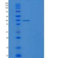 人精子赤道片段蛋白1/SPESP1重组蛋白C-6His