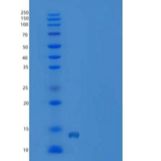 人R-脊椎蛋白1(RSPO1)重组蛋白aa 1-146, His tag