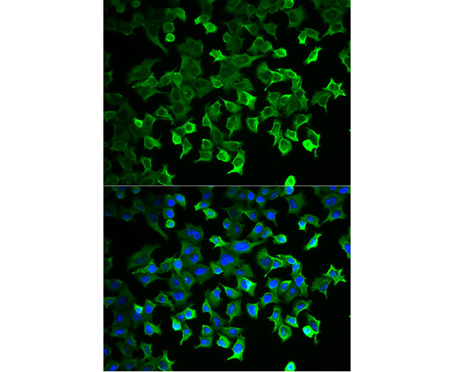 HSP70 Rabbit Polyclonal Antibo