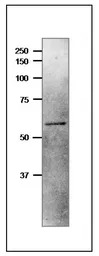 NiR antibody