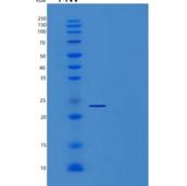 人CD44/MIC4重组蛋白C-6His