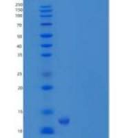 人CEACAM7/CGM2重组蛋白C-6His