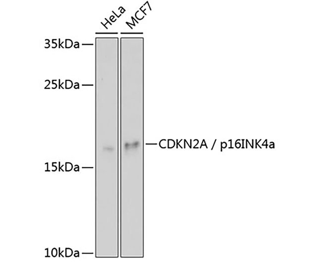 CDKN2A/p16INK4a Rabbit Polyclo