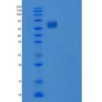 人肝配蛋白B受体6(EPHB6)重组蛋白