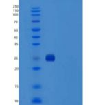小鼠CD122 / IL2RB / IL2受体β重组蛋白His tag