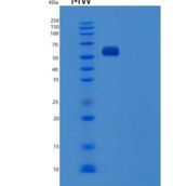人血清白蛋白/ HSA /白蛋白重组蛋白