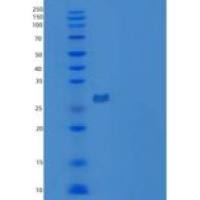 人触珠蛋白/Zonulin重组蛋白N-6His