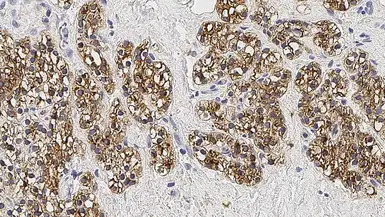 Parathyroid Hormone antibody [