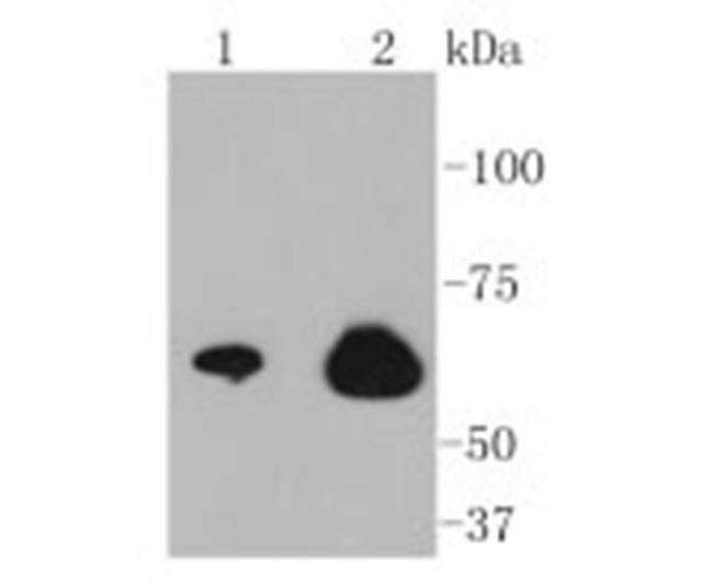 NF-kB p65 Rabbit Monoclonal An