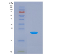 人泛素交叉反应蛋白(UCRP)重组蛋白