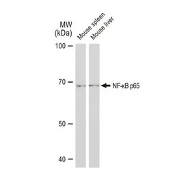 NFkB p65 antibody [GT1185]