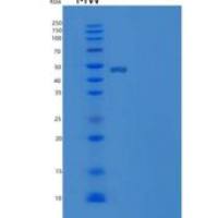 人SerpinF1 / PEDF重组蛋白His tag