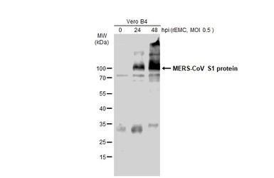 MERS-CoV Spike (S1) antibody