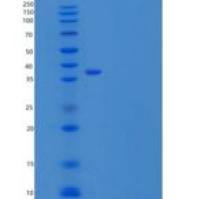 人硫酸酯酶修饰因子1(SUMF1)重组蛋白C-6His
