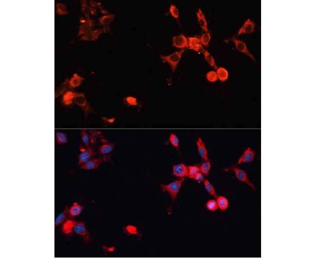 HSP70 Rabbit Polyclonal Antibo