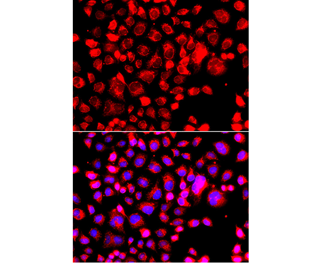 ccl11 rabbit polyclonal antibody价格_品牌:信裕生物