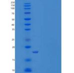 人热休克蛋白β-11/HSPB11重组蛋白N-6His