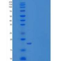 人热休克蛋白β-11/HSPB11重组蛋白N-6His