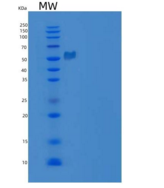 人甾醇O-酰基转移酶2/SOAT2/ACAT2重组蛋白N-T