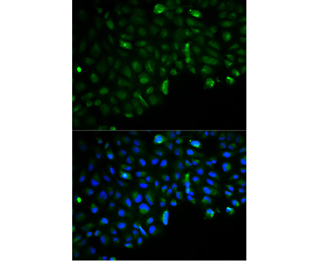 Hexokinase II Rabbit Polyclona