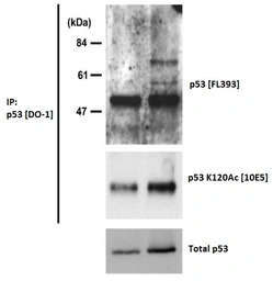 p53 (Acetyl Lys120) antibody [