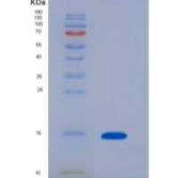 人趋化因子C-C-基元配体16(CCL16)重组蛋白