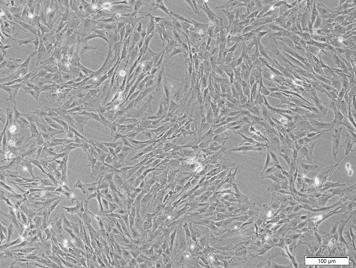 rBMSC-SV40-GFP (大鼠永生化骨髓间充质干细胞)