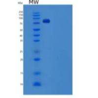 人SCARB1 / CD36L1 / CLA-1重组蛋白His & Fc tag