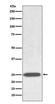 AQP1 Rabbit Monoclonal Antibod