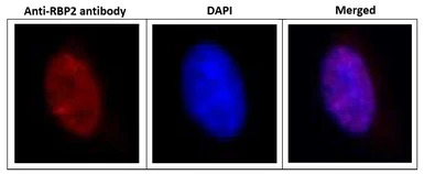 KDM5A / Jarid1A / RBBP2 antibo