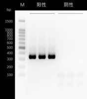 人冠状病毒HKU1 RT-PCR试剂盒